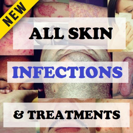 Skin Infections and Treatments - Medical App | MWM