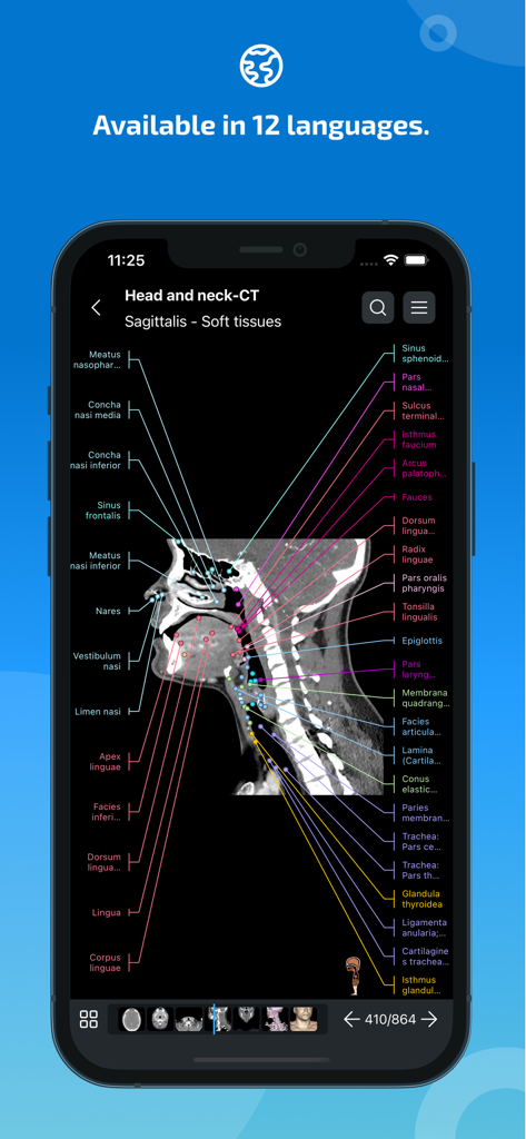 Aplicativo IMAIOS e-Anatomy exibindo um exame de TC sagital rotulado da cabeça e pescoço.