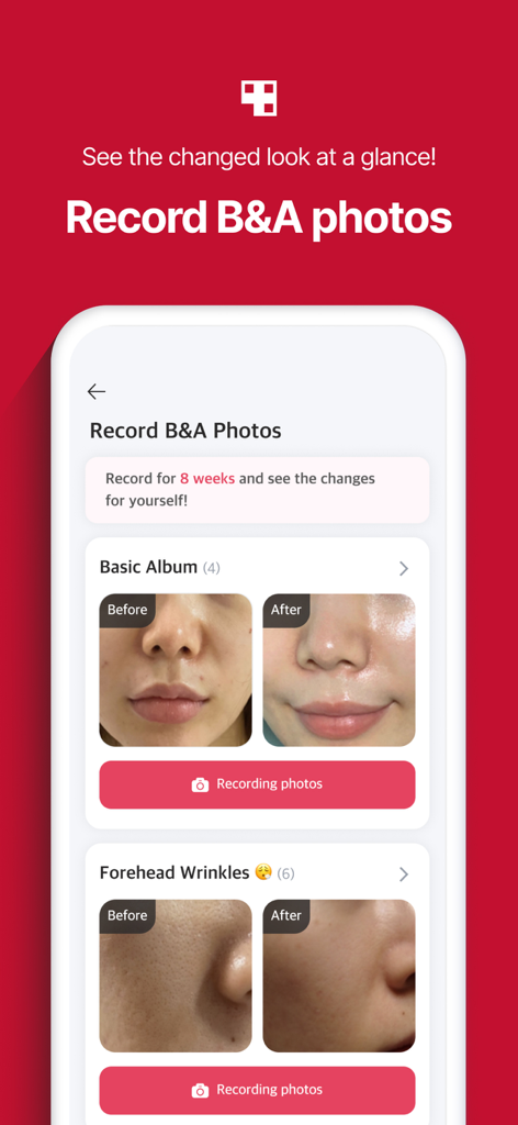 AGE-R medicube Digital clinic - AGE-Rアプリのインターフェース。肌の変身のビフォーアフター比較写真が表示されています。