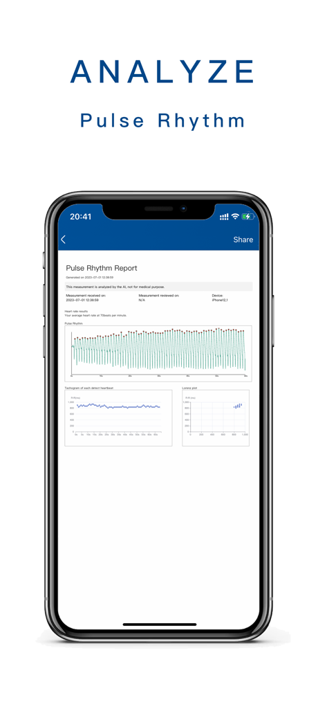 Instant Pulse - Blood Pressure - A smartphone screen displaying a pulse rhythm report with multiple heart rate analysis graphs