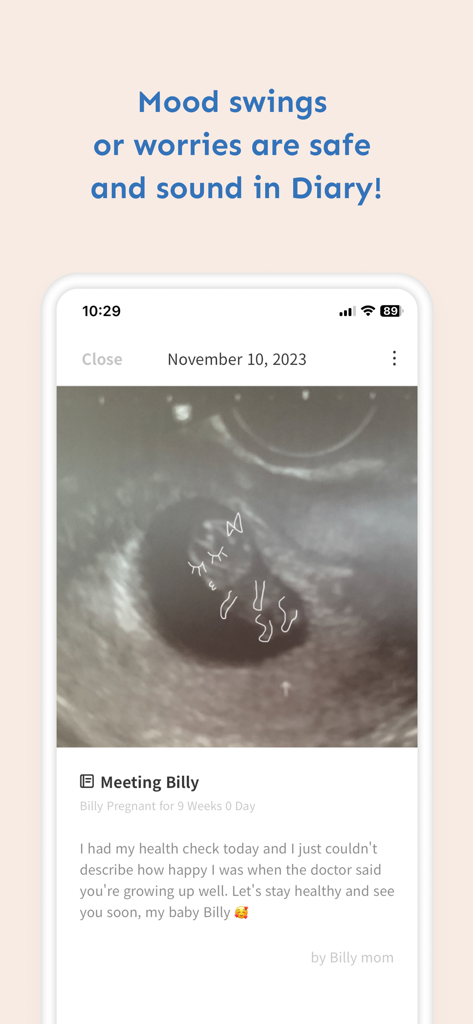 Baby Billy app screenshot showing a personal pregnancy diary entry with an ultrasound photo and emotional journal note