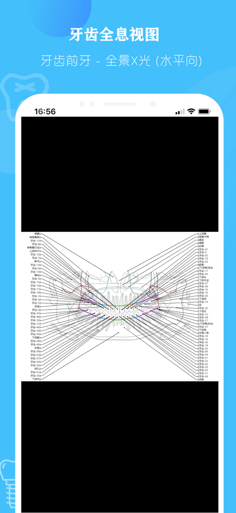 口腔解剖图 — 口腔牙科精美科普全息插图 - Diagramma olografico etichettato di una radiografia panoramica dentale che mostra la struttura di denti e mascella.