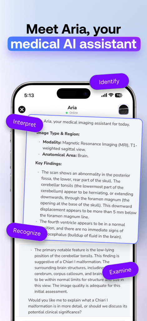 AI Doctor & Radiology-Med Scan - MedScan AI app interface showing a detailed radiology report from the medical AI assistant Aria