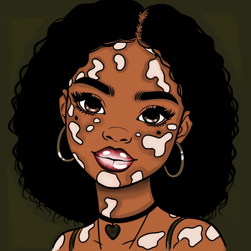 bleautiful black girl with vitiligo