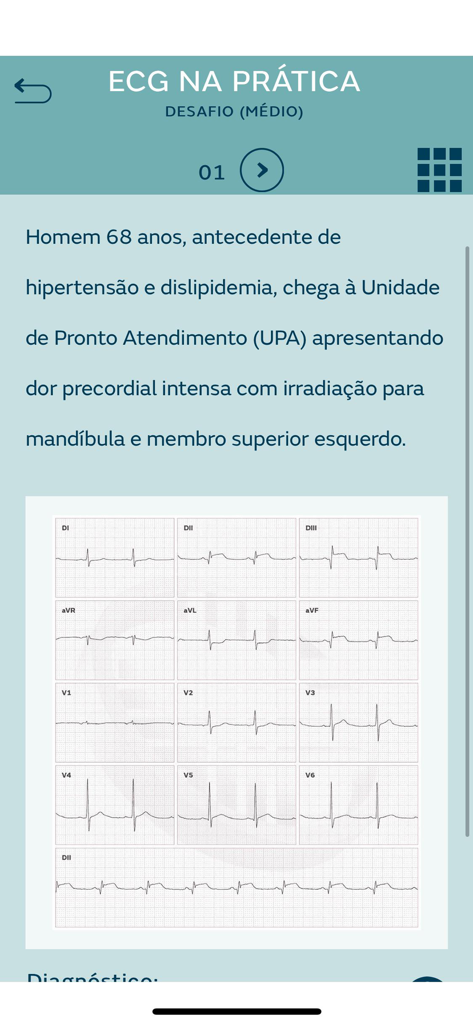 MEDELETRO - Tela do aplicativo MEDELETRO mostrando um estudo de caso clínico com um traçado de ECG de 12 derivações para treinamento médico.