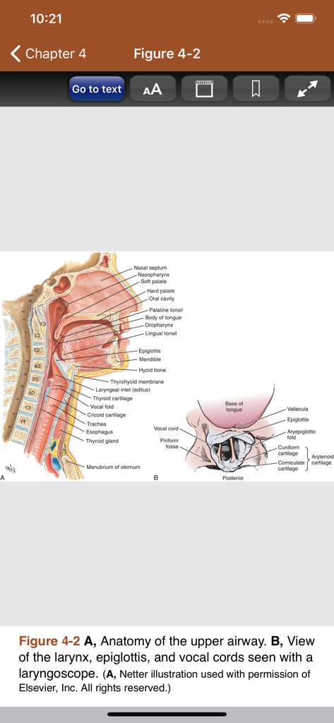 Medical illustration showing the anatomy of the upper airway and a laryngoscope view of the larynx
