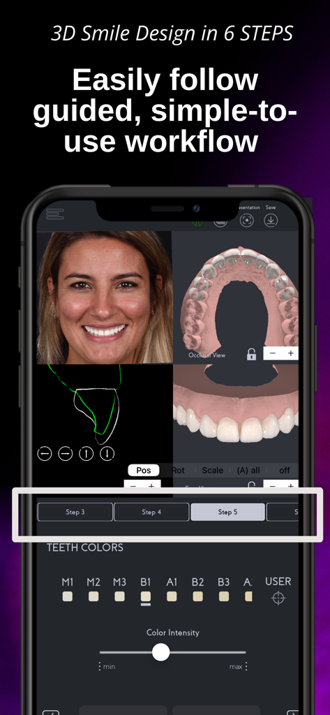SmileFy TNG - Interfaz de la aplicación SmileFy TNG que muestra un flujo de trabajo guiado de 6 pasos para el diseño de sonrisas 3D con foto del paciente y modelos dentales