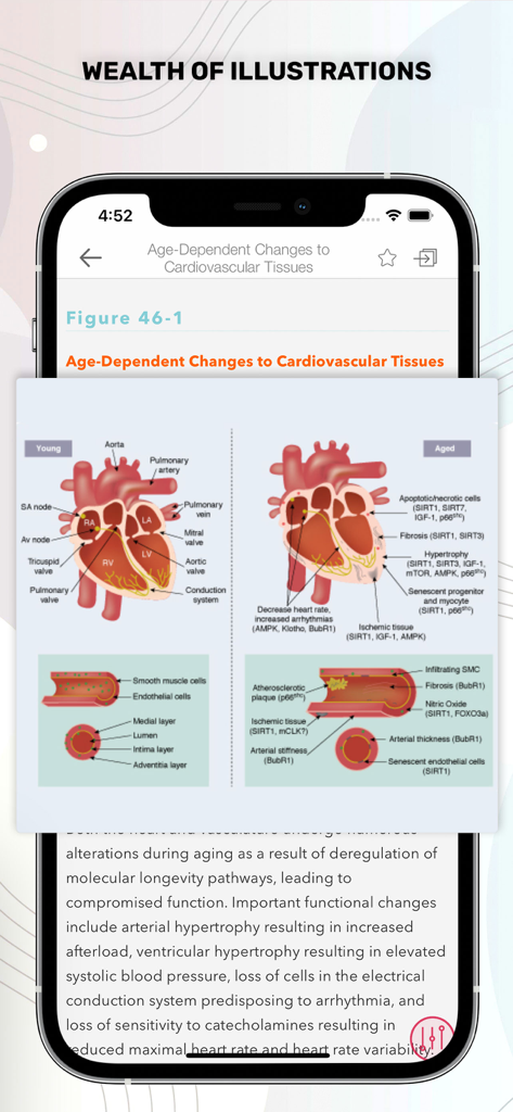 Stoelting Anesthetic Practice - Medical illustration comparing young and aged cardiovascular tissues in the Stoelting Anesthetic Practice app