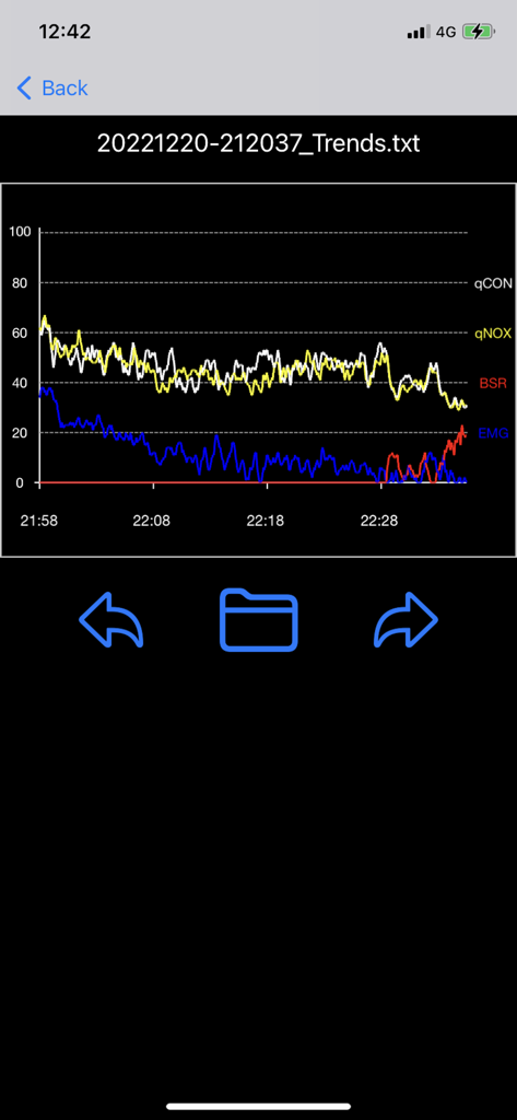 ConoxView - A line graph in the ConoxView app displaying anesthesia monitoring trends including qCON and qNOX indices over time
