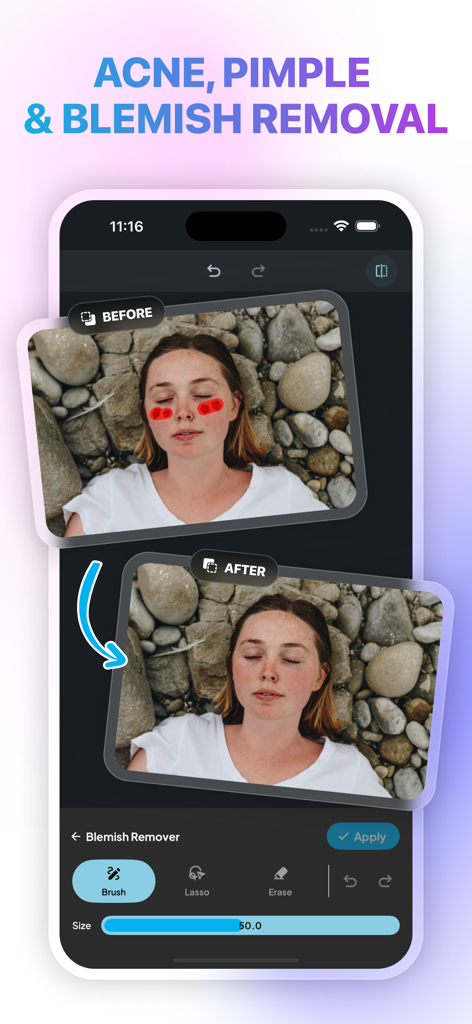 Photo Remove Unwanted Object - Ein Vorher-Nachher-Vergleich, der die Entfernung von Akne und Hautunreinheiten im Gesicht einer Frau mit einem KI-Fotobearbeitungstool zeigt.