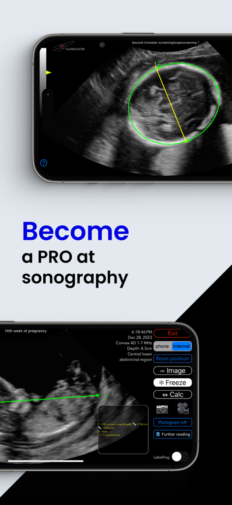 Scanbooster app interface showing fetal ultrasound simulation and medical measurement tools on smartphone screens