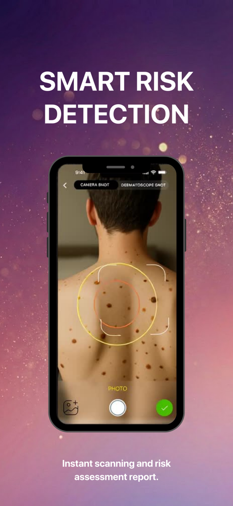 Smartphone interface showing AI skin scanning for mole risk assessment.