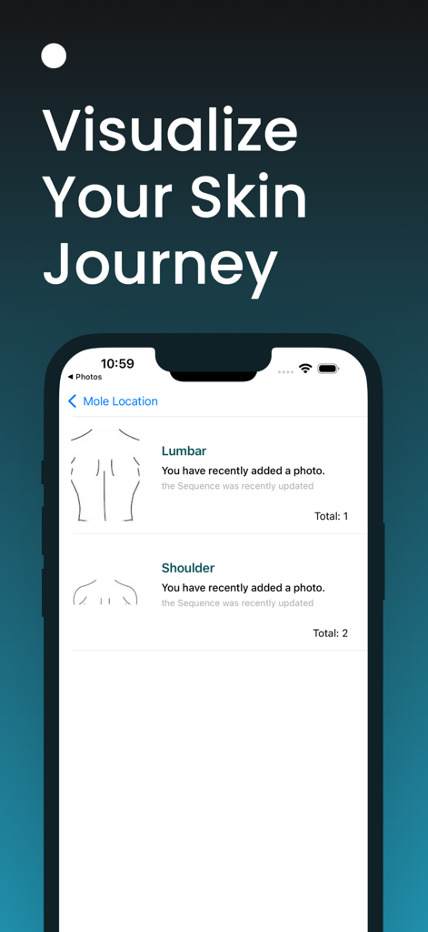 AI Skin Scanner: Skincare Time - A screenshot of the AI Skin Scanner app showing the mole location tracking screen for lumbar and shoulder areas.
