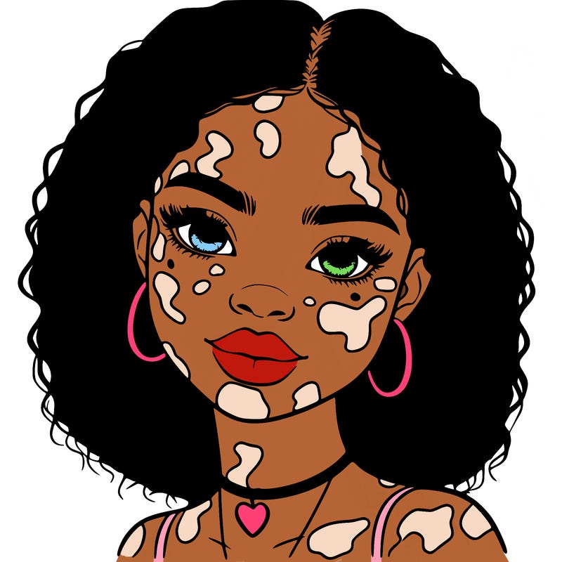 bleautiful black girl with vitiligo