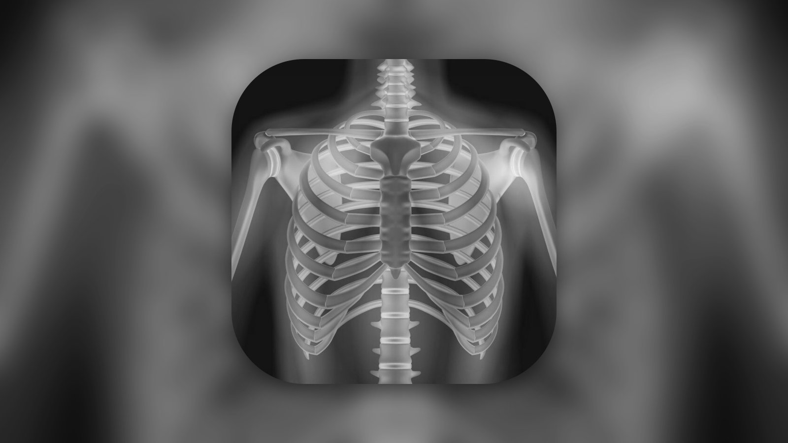 XRay - Sublux Anatomy Learning - Medical App | MWM