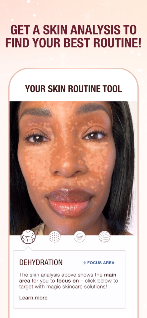 CHARLOTTE TILBURY: EASY BEAUTY - A mobile app screen showing an AI skin analysis identifying dehydration on a user's face.