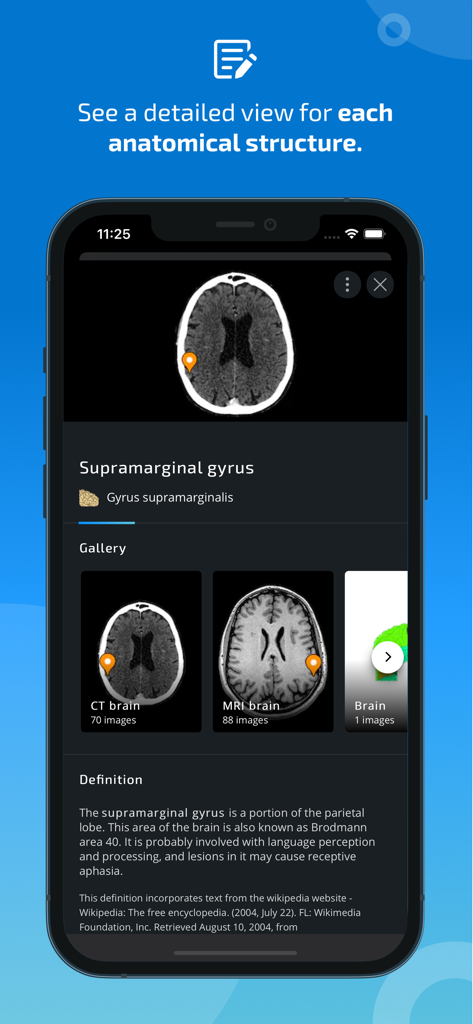 Visão anatômica detalhada do giro supramarginal no aplicativo IMAIOS e-Anatomy.