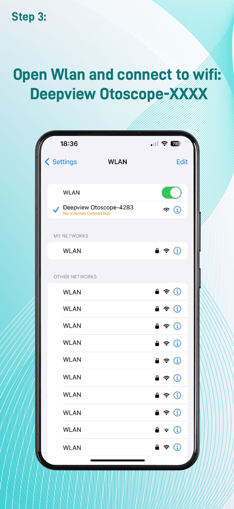 Ent Insight - A setup screen showing how to connect an iPhone to the Deepview Otoscope wireless network in the WLAN settings