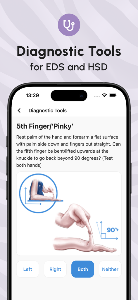 The Ehlers-Danlos Society - Screenshot dell'app Ehlers-Danlos Society che mostra uno strumento diagnostico per testare l'iperestensibilità del mignolo con istruzioni e illustrazione.