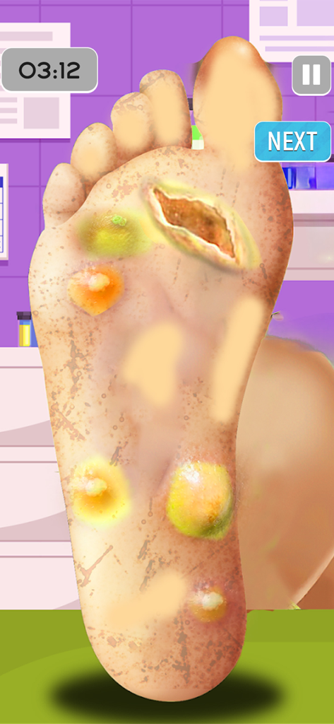 ASMR Foot Care: Doctor Games - Gameplay of ASMR Foot Care Doctor Games showing foot medical treatment