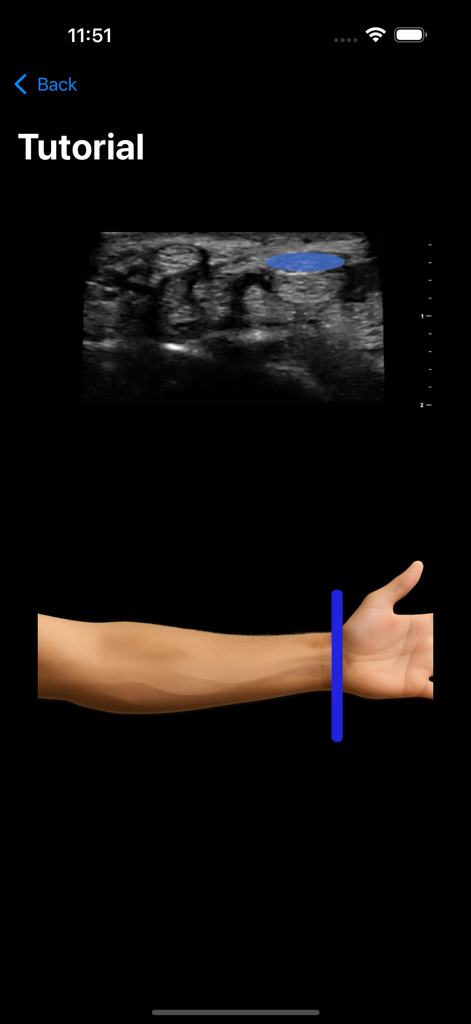 MSK VUE - Tutorial screen from MSK VUE showing an ultrasound image scan and the corresponding location on a human arm diagram.