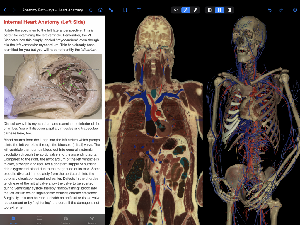 VH Dissector Pro - VH Dissector Pro interface showing internal heart anatomy lessons with cross-sectional and 3D human models on an iPad