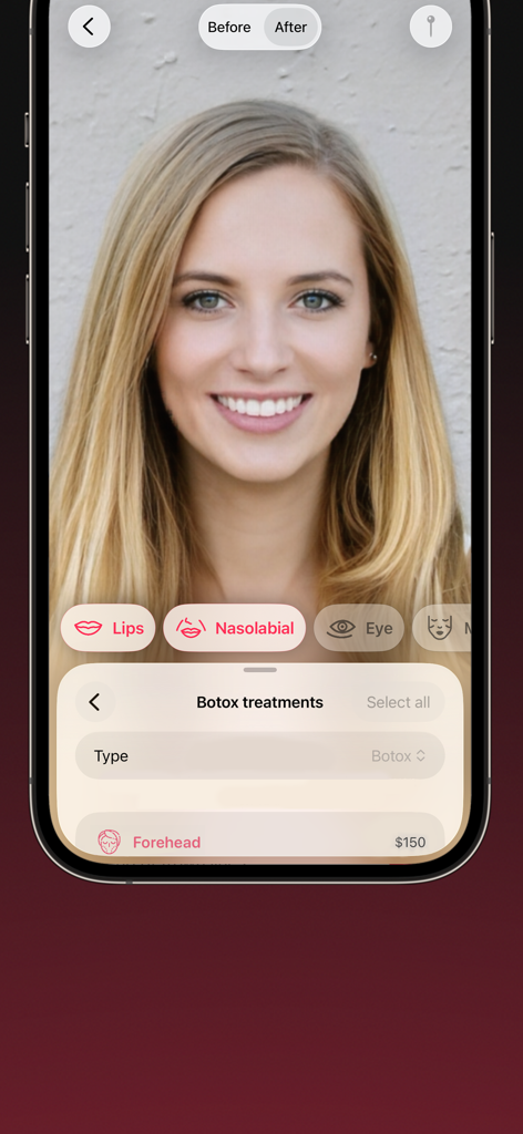 AI Aesthetics: Face Cosmetics - AI Aesthetics app interface showing a facial simulation for Botox treatments on the forehead with a price estimate