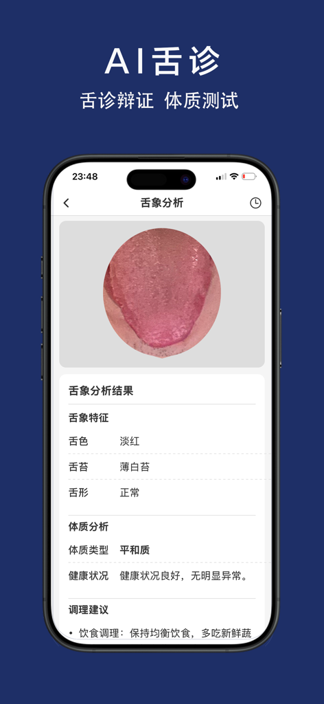 有方中医 - 方剂大全升级版，AI舌诊识方，中医自学智库 - A mobile phone screen displaying the AI tongue diagnosis feature in the Youfang TCM app