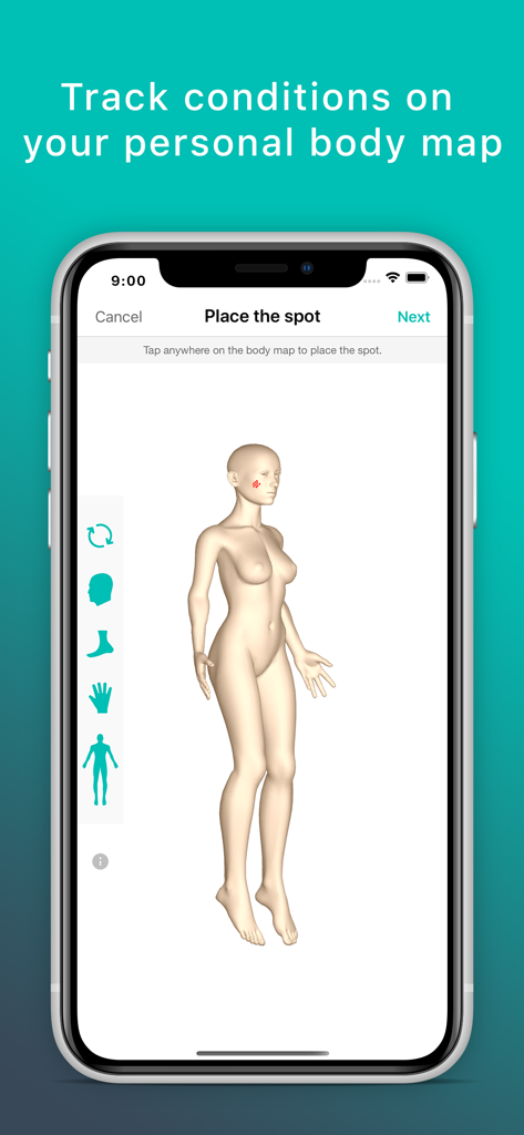 Skin App - Online Dermatology - Eine 3D-Körperkarte einer Frau auf einem Smartphone-Bildschirm zur Verfolgung von Hauterkrankungen in der Haut-App.