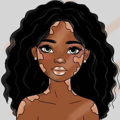 beautiful black girl with vitiligo