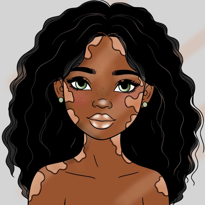 beautiful black girl with vitiligo