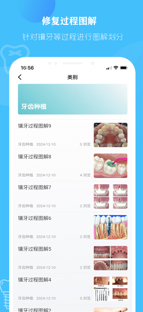 口腔解剖图 — 口腔牙科精美科普全息插图 - Elenco di diagrammi di procedure di restauro dentale e impianti nell'app Oral Anatomy.