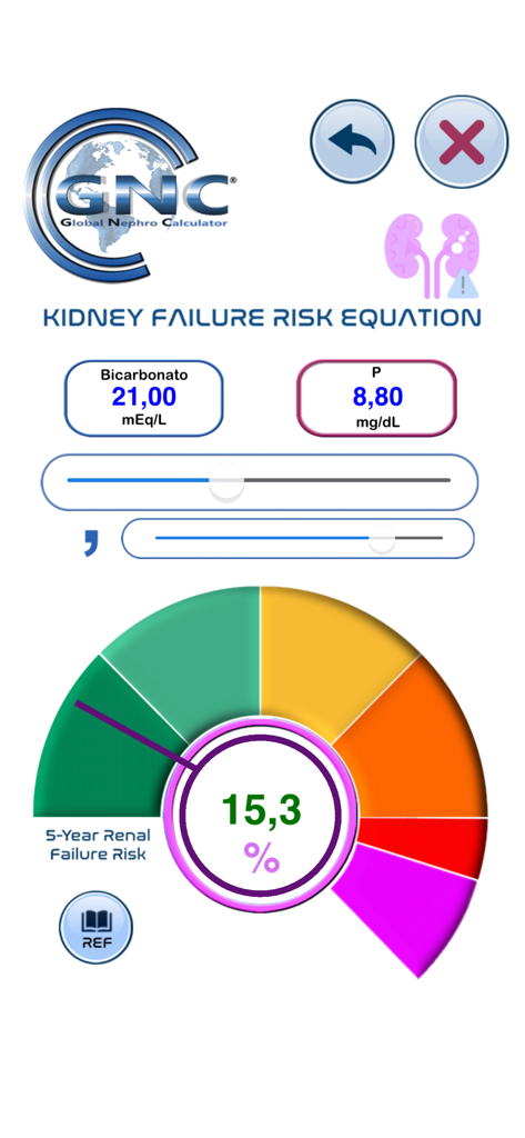 Global Nephro Calculator - グローバル腎臓計算機インターフェース。腎不全リスク方程式の結果が表示され、15.3%の5年リスクを示すゲージがあります。