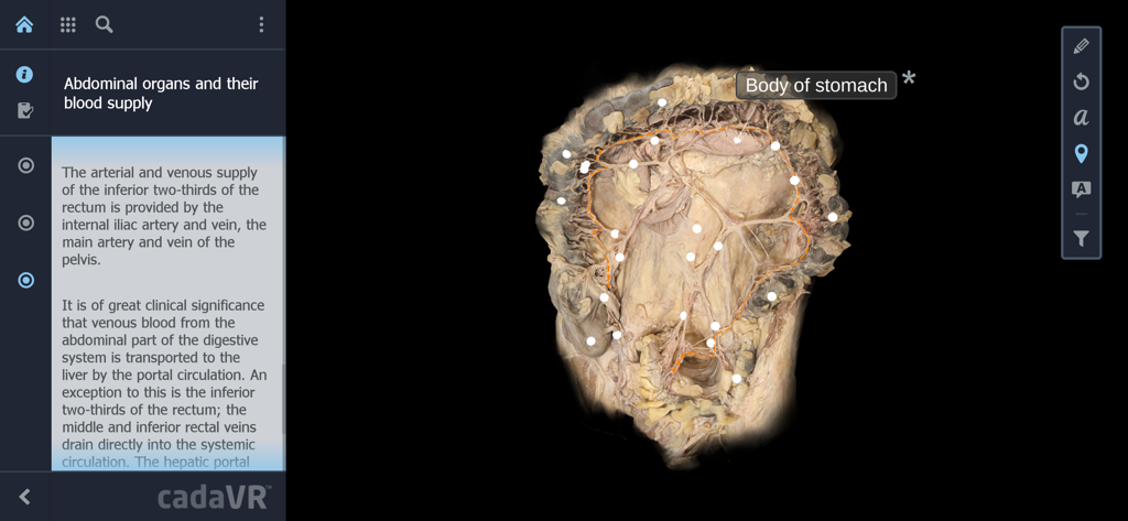 Interactive 3D photogrammetry model of abdominal organs and blood supply in the cadaVR anatomy app