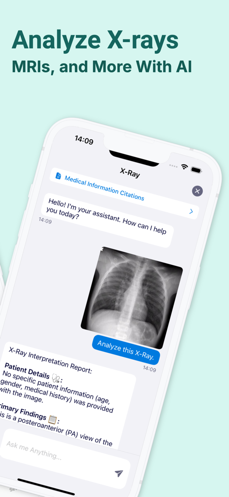 Med GPT app interface showing AI assistant providing a chest xray interpretation report