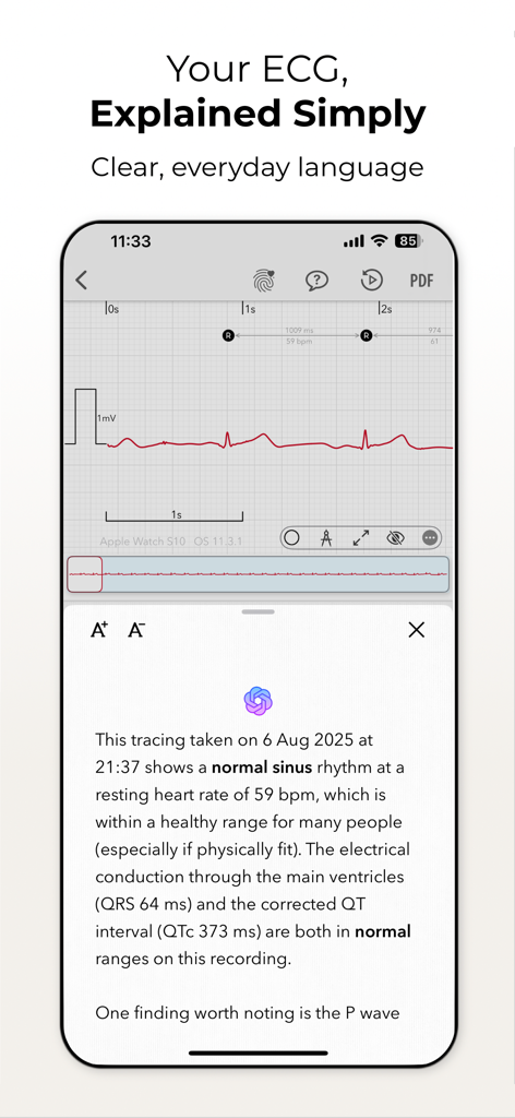ECG+ | Your Watch ECG Reader - Mobile app screen showing an ECG waveform with a simple text-based explanation of the heart rhythm results.