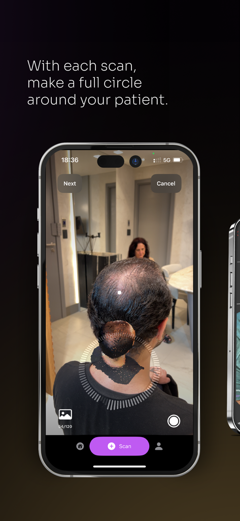 A medical professional using a smartphone to perform a 3D scalp scan on a patient for hair transplant planning.