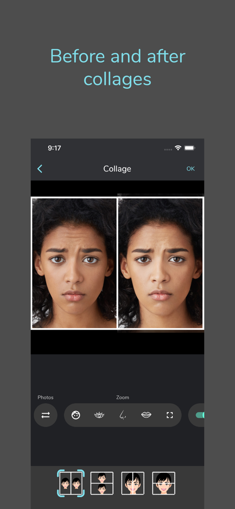 PhotoDoc - Interface of PhotoDoc app showing a side by side patient facial collage for medical comparison