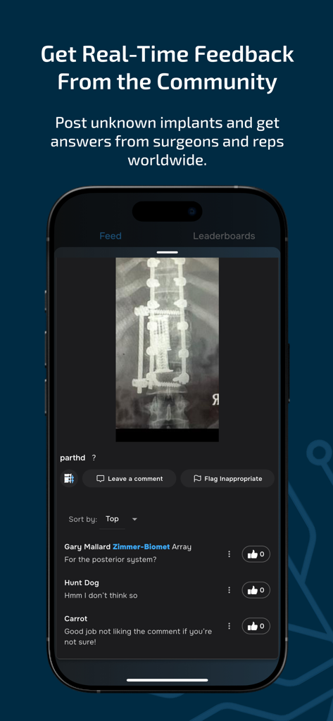 Implant Identifier - App screen showing a medical community discussing a spinal implant x-ray for identification