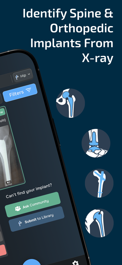 Implant Identifier - App screen showing identification of spine and orthopedic implants from x-ray images