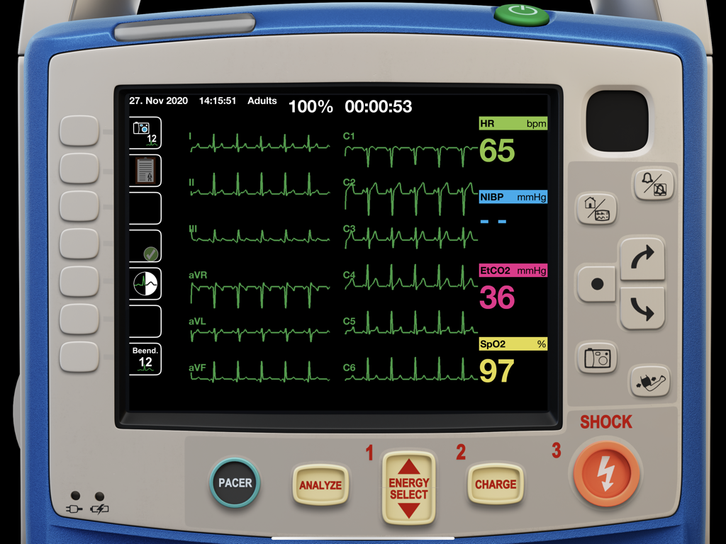 Digital simulation of a medical monitor screen with ECG waveforms and vital signs