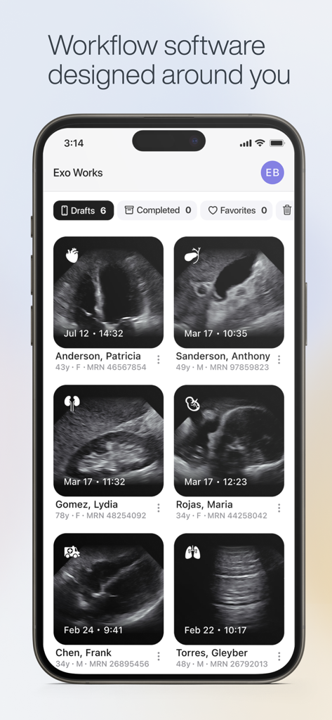 Exo Iris™ - Smartphone screen showing the Exo Iris app workflow interface with multiple patient ultrasound scan records.