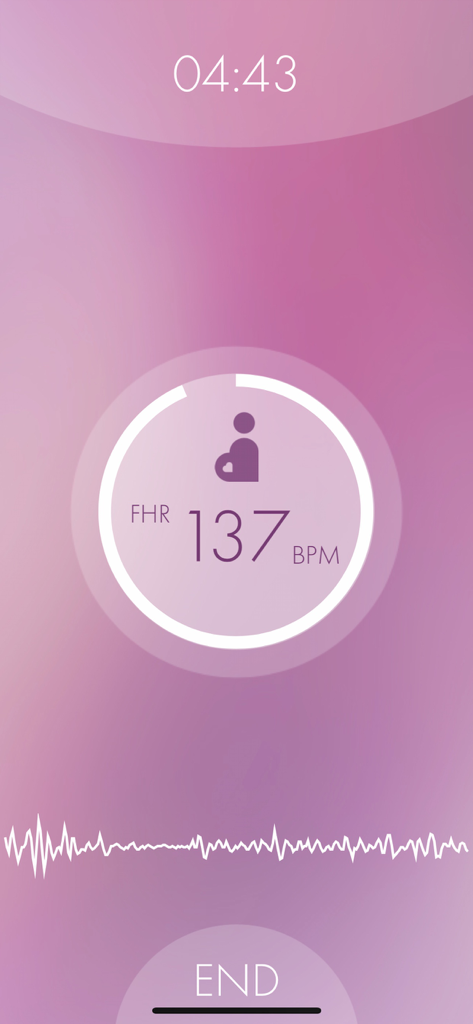 HeraBEAT - HeraBEAT app interface displaying a fetal heart rate of 137 BPM with a heartbeat waveform