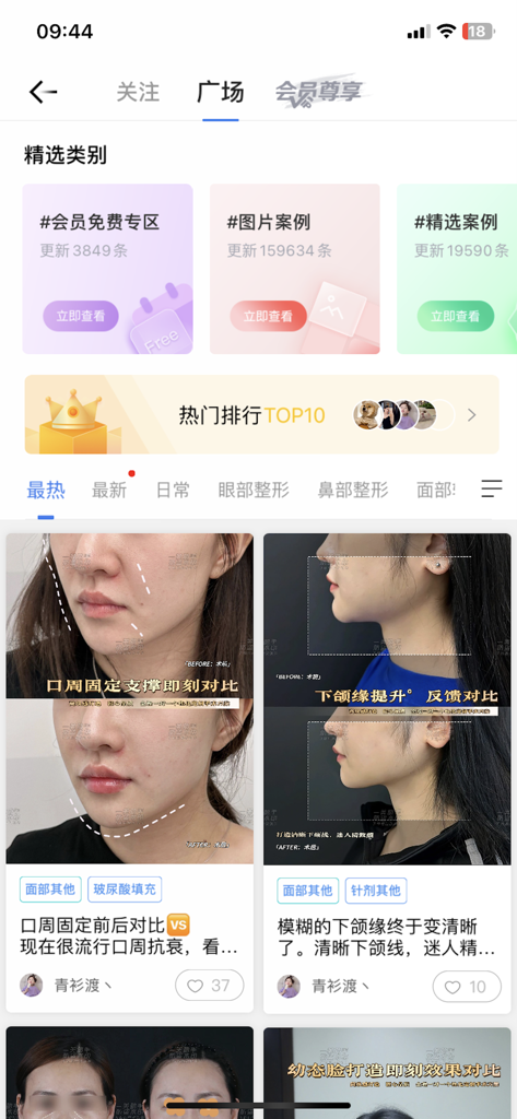 一美助手 - Discovery screen of One Beauty Assistant app featuring Asian medical aesthetic before and after cases