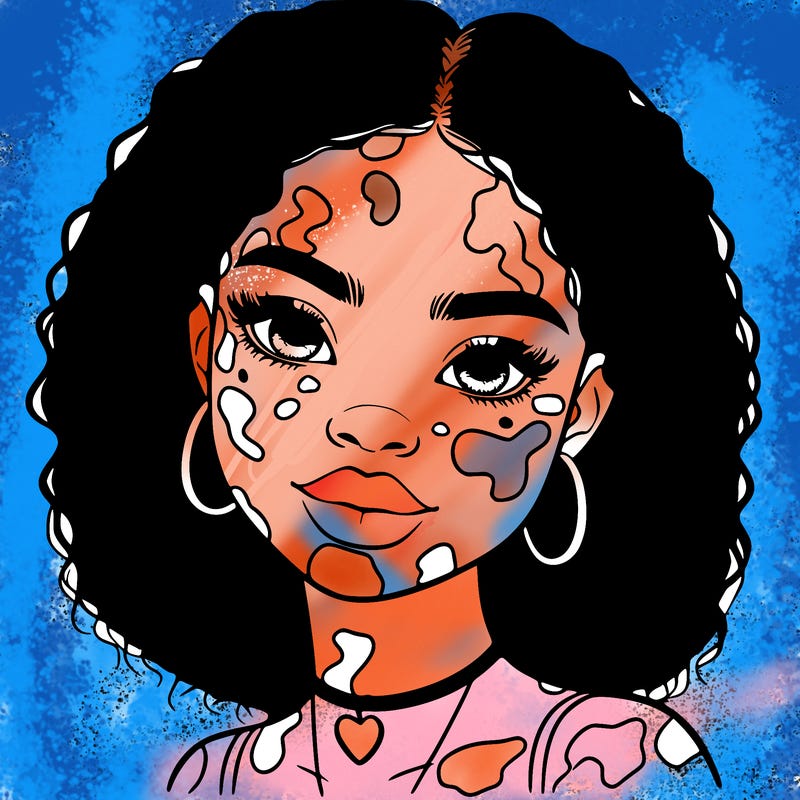 bleautiful black girl with vitiligo