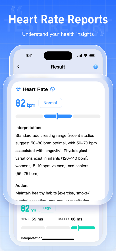 A mobile app interface displaying a detailed heart rate report with normal bpm status and medical interpretation.