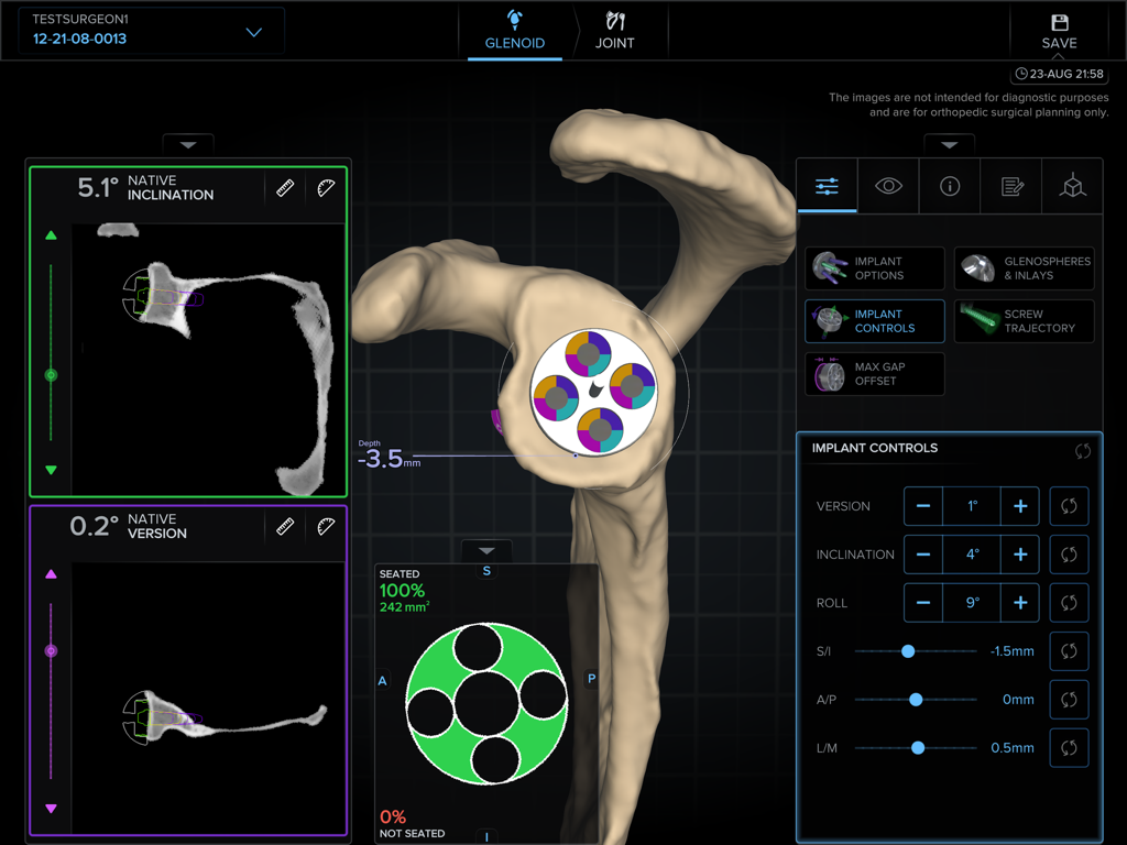 ArthrexVIP app interface showing a 3D shoulder bone model with precision implant placement and orientation controls