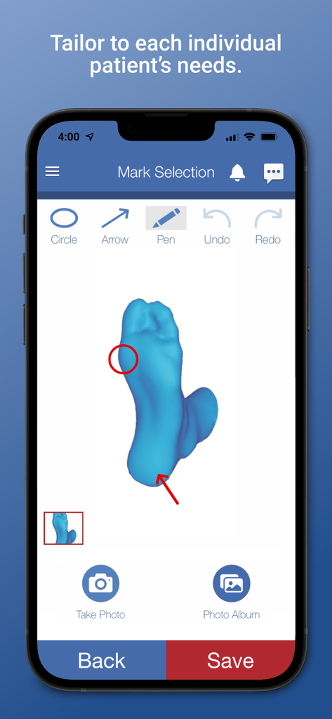 Forward Motion Medical - A 3D foot scan with red markings and annotation tools in the Forward Motion Medical app