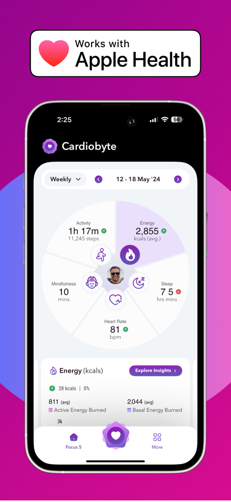 Heart Rate Monitor: Cardiobyte - Painel do aplicativo Cardiobyte exibindo níveis de sono e atividade de frequência cardíaca com integração Apple Health.