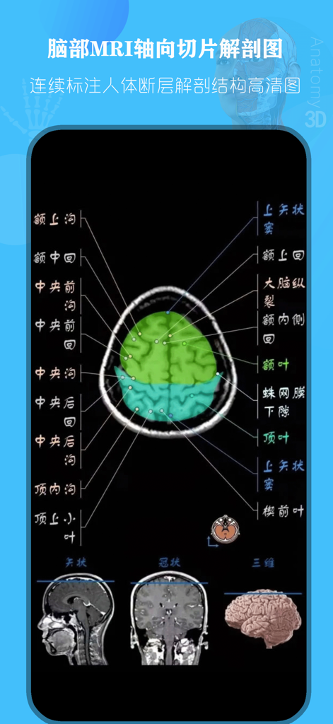 人体解剖学图谱 - 2025【专业版】 - Sección axial de RM cerebral etiquetada en la aplicación móvil Human Anatomy Atlas.